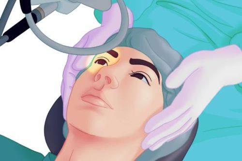 汪毓明医生擅长项目