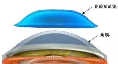 袁州爱瞳眼科门诊部预约挂号方式及流程