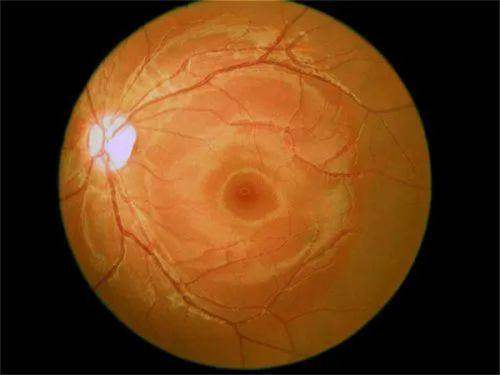 袁州爱瞳眼科门诊部特色项目及技术优势