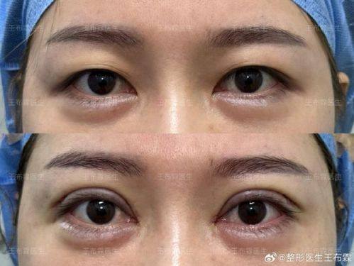 顺德东方女子医院整形美容科收费价格表/收费标准