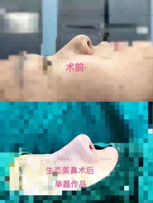 广州艾美医疗美容整形门诊部真人口碑评价怎么样？
