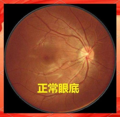 湘雅常德医院眼科地址电话营业时间