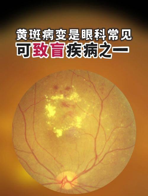 荆门市第一人民医院眼科特色项目及技术优势