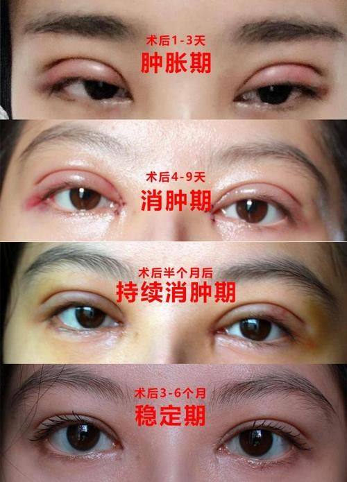 广州艾美医疗美容整形门诊部详细的预约挂号方式及流程