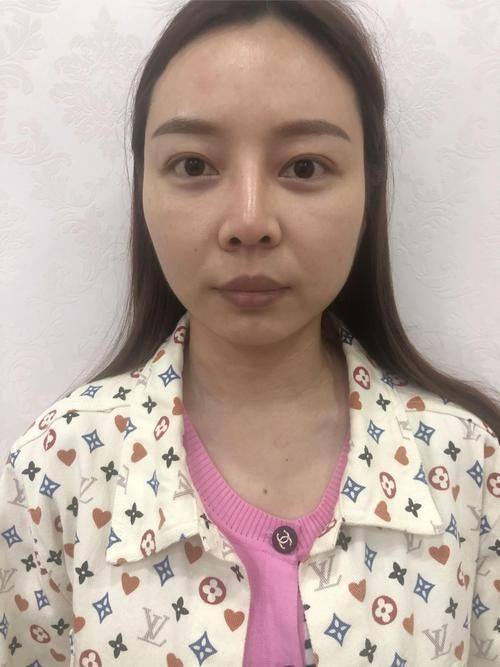 顺德东方女子医院整形美容科是正规医院吗？