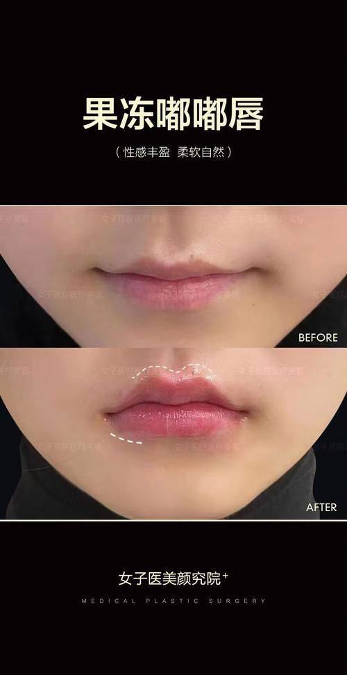 重庆如壹整形医院收费价格表/收费标准