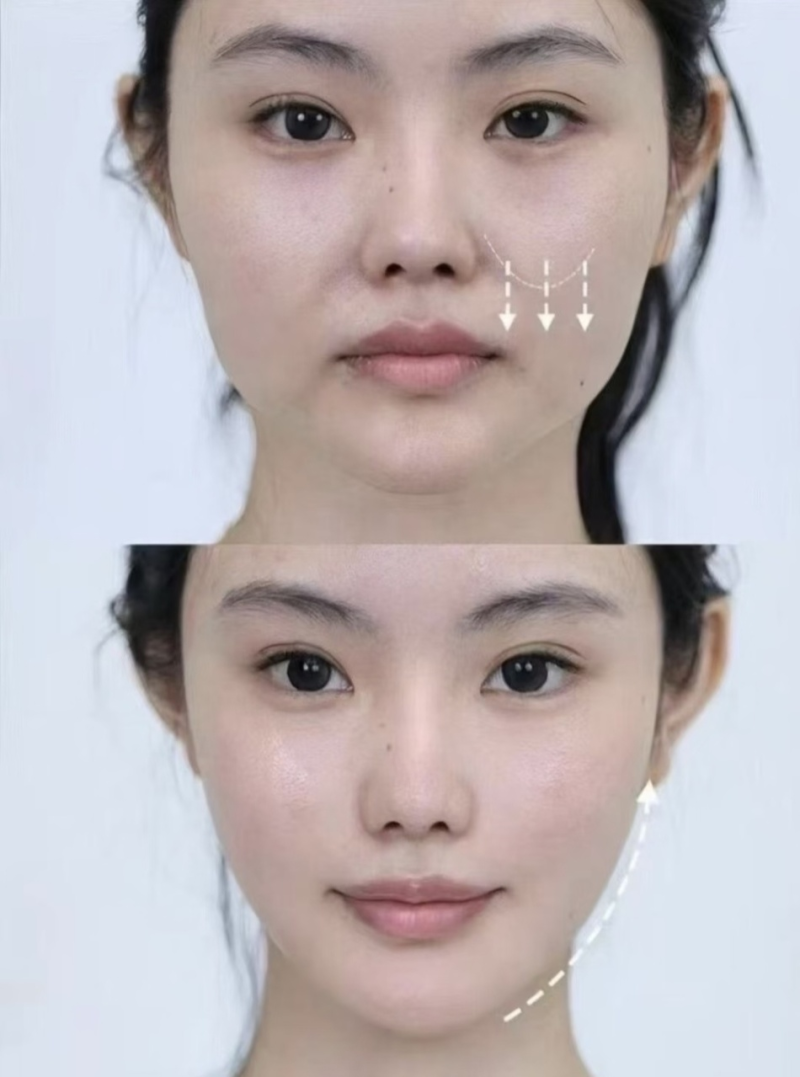 广州艾美医疗美容整形门诊部是正规医院吗？