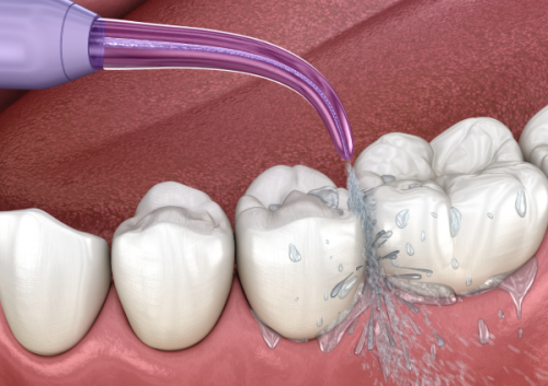 乌兰察布市陈氏口腔是正规医院吗？