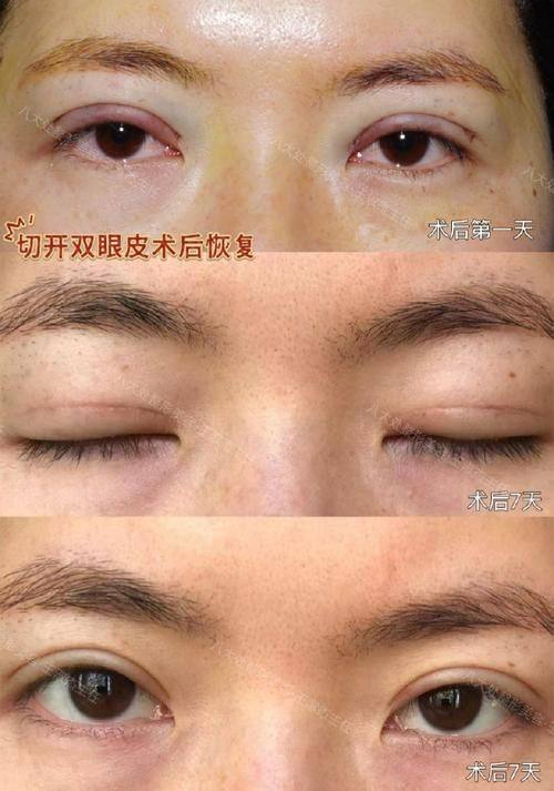 合肥亦生医疗美容真人口碑评价怎么样?