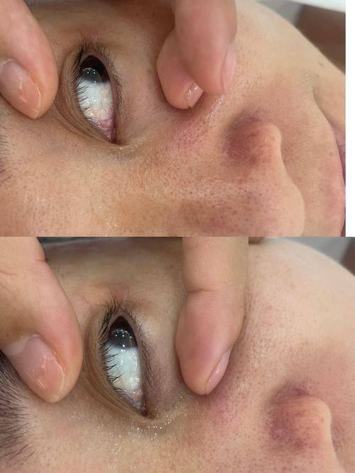 六盘水时光整形美容医院真人口碑评价怎么样？