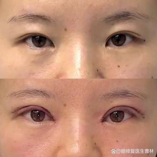 宁波海曙珈禾整形医院是正规医院吗?