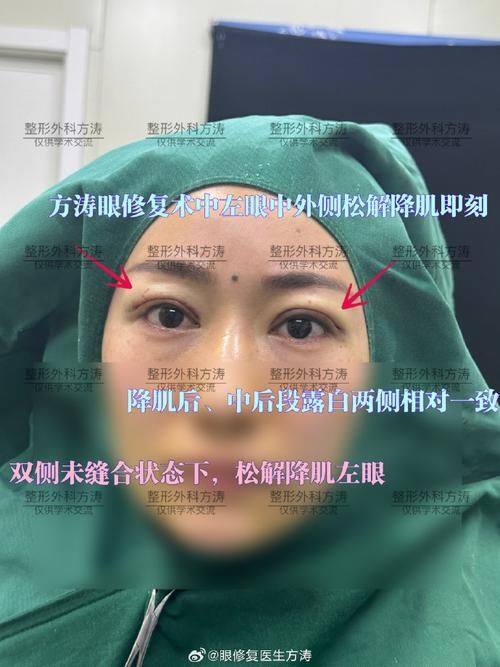 六盘水时光整形美容医院是正规医院吗？