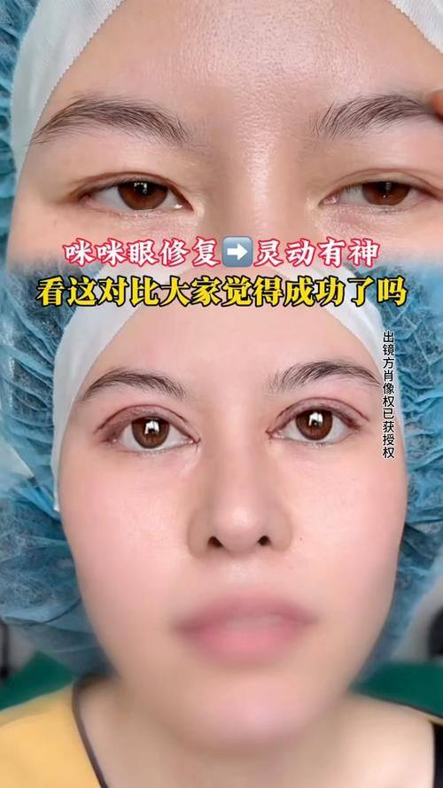 合肥亦生医疗美容收费价格表/收费标准