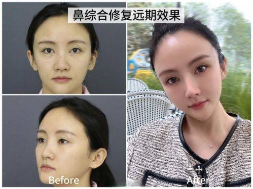 成都玉之光整形美容医院收费价格表/收费标准