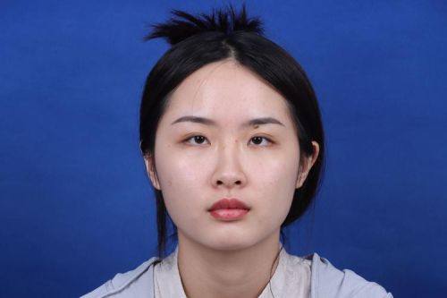 自贡邹剑医学美容诊所特色项目及技术优势