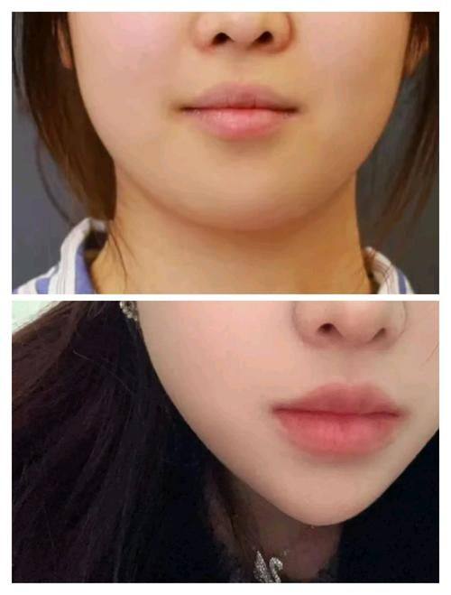 成都玉之光整形美容医院地址电话营业时间