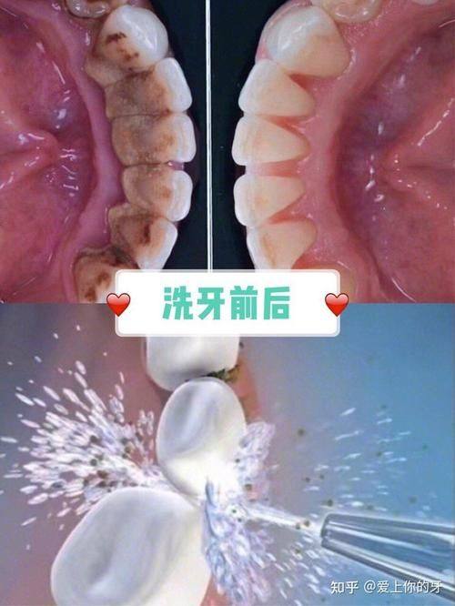 乌兰察布市陈氏口腔真人口碑评价怎么样？