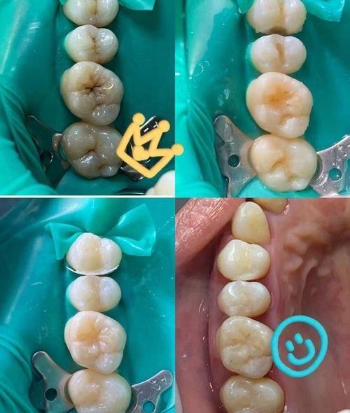 广东深圳雅捷口腔诊所特色项目及技术优势
