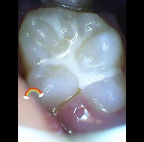山东临沂华诺口腔真人口碑评价怎么样？