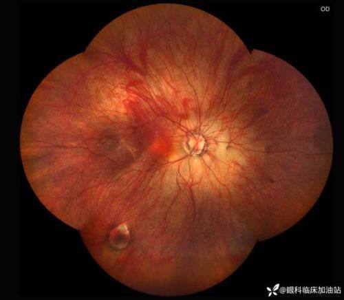 成都市双流区第一人民医院眼科详细的预约挂号方式及流程