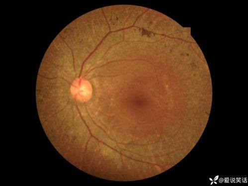 茂名市人民医院详细的预约挂号方式及流程