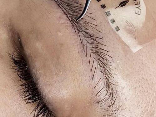 武汉新菲妍整形医院特色项目及技术优势