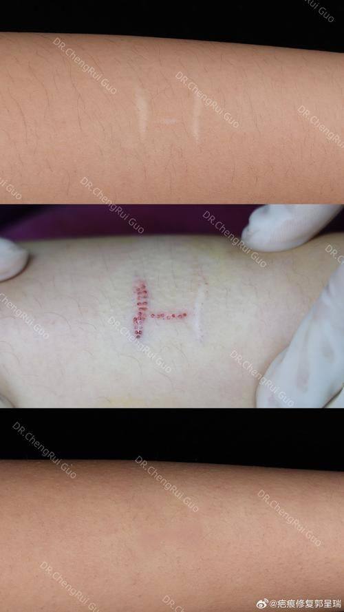 合肥臻越医疗美容门诊部真人口碑评价怎么样？