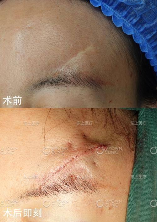 合肥臻越医疗美容门诊部收费价格表/收费标准