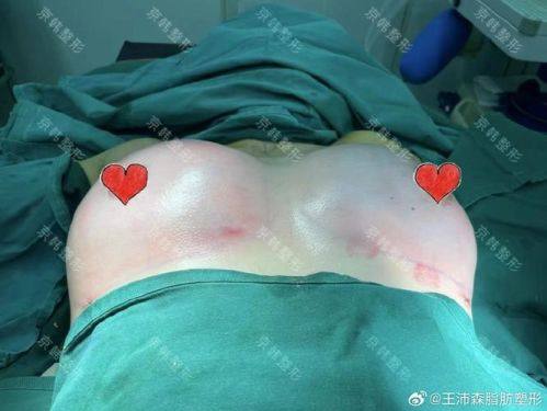 宁波海曙珈禾整形医院地址电话营业时间