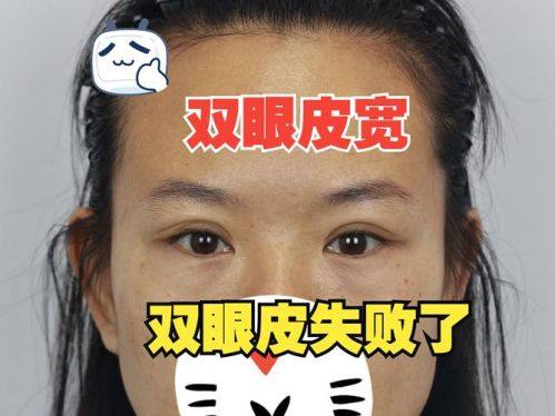 合肥亦生医疗美容是正规医院吗?