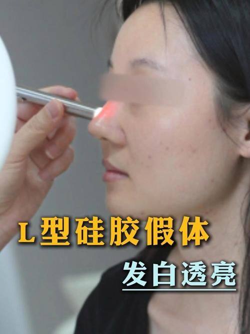 合肥臻越医疗美容门诊部特色项目及技术优势