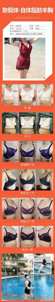 宁波海曙珈禾整形医院特色项目及技术优势