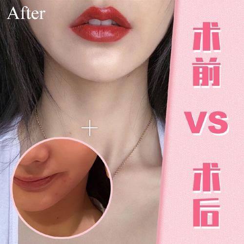 武汉新菲妍整形医院是正规医院吗？