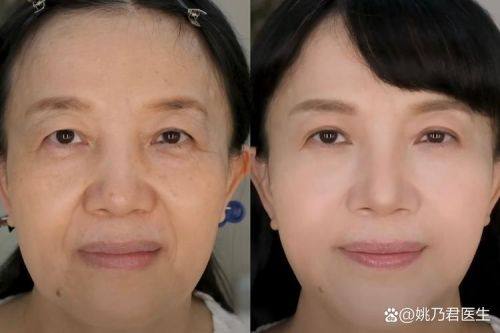 大同清木整形医院详细的预约挂号方式及流程