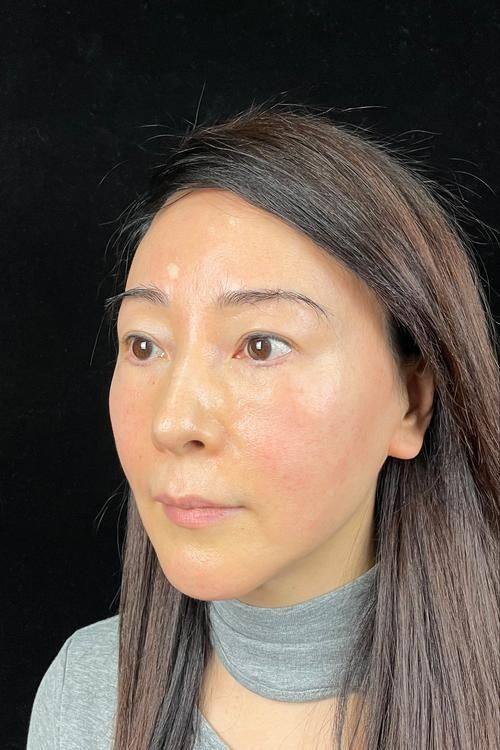 大同清木整形医院特色项目及技术优势