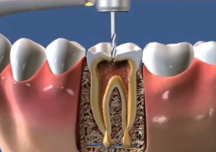 林美岑医生擅长项目