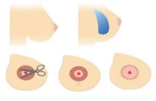 姜会庆医生技术优势