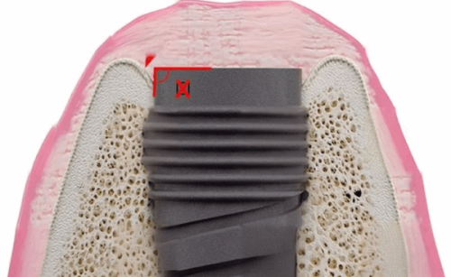 洪峰医生价格表