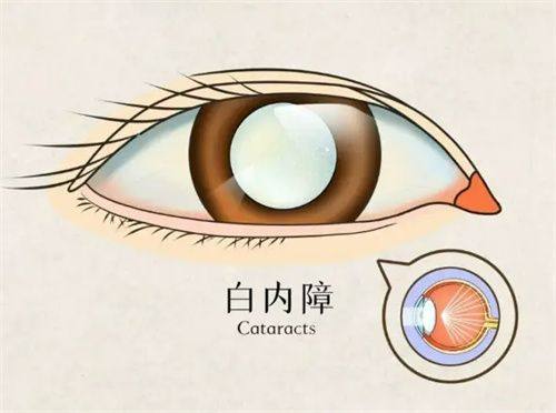 宁波市医疗中 心李惠利医院眼科收费价格表/收费标准