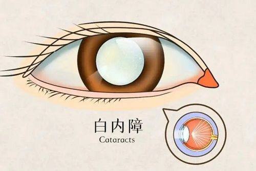 河北北方学院附属第二医院眼科详细的预约挂号方式及流程
