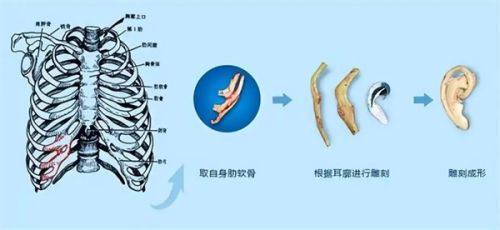 新乡穆大夫整形美容医院特色项目及技术优势