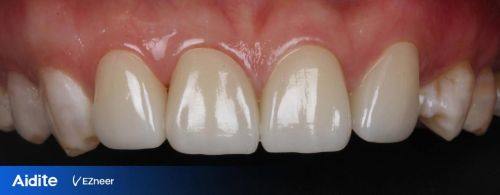 南京乐齿健口腔特色项目及技术优势