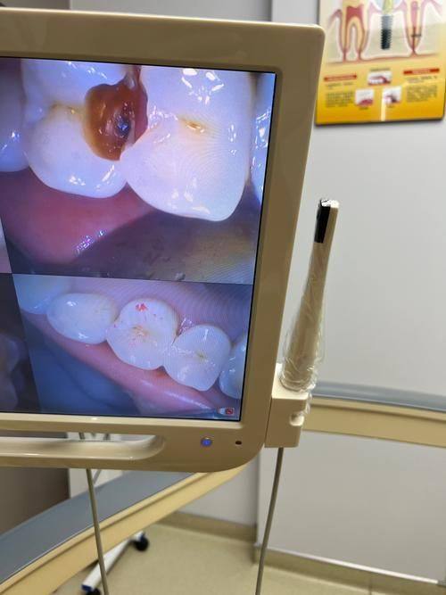 西安种永锋口腔真人口碑评价怎么样？