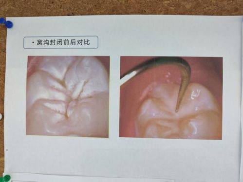 山西吕梁春珍齿科医院真人口碑评价怎么样？