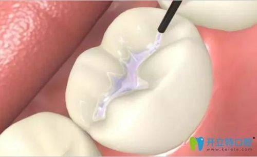 南京乐齿健口腔收费价格表/收费标准