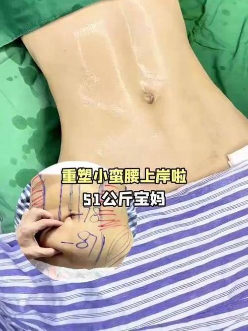 西安致美整形医院地址电话营业时间