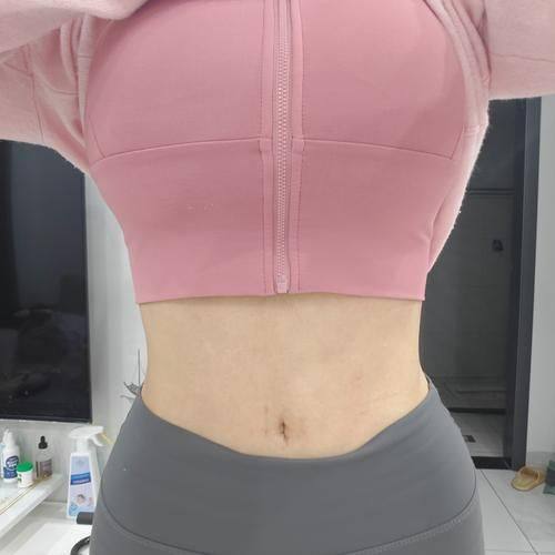 西安致美整形医院真人口碑评价怎么样?