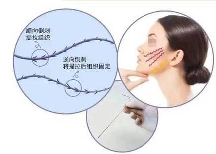 日本Takami美容整形医院真人口碑评价怎么样？