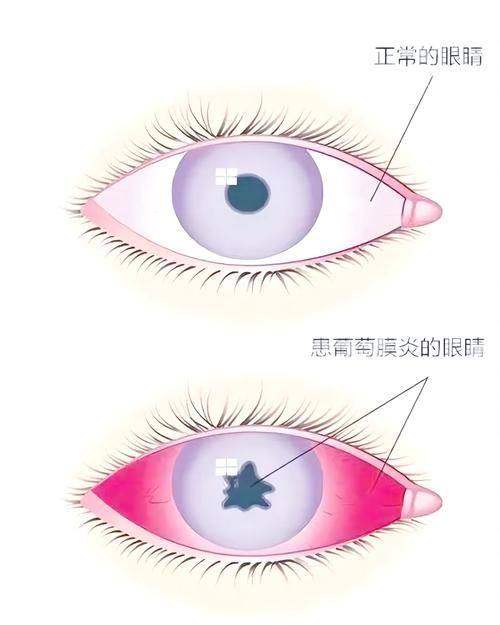 乌鲁木齐市中医院眼科是正规医院吗？