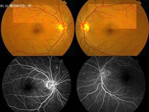 河北北方学院附属第二医院眼科特色项目及技术优势